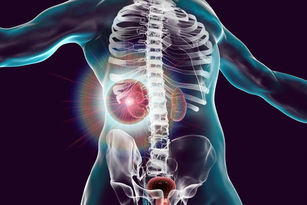 Scientists Have Discovered a “Powerhouse” Gene, Opening Doors to New Treatments for Kidney Disease.webp
