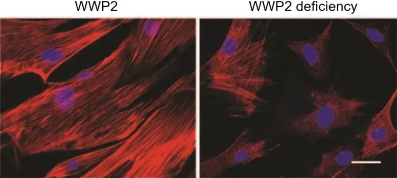 WWP2-Gene-Action.webp